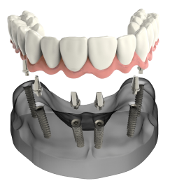 Teeth Image